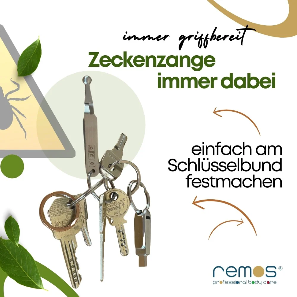 Mini Zeckenpinzette in Löffelform von Remos – Bild 4